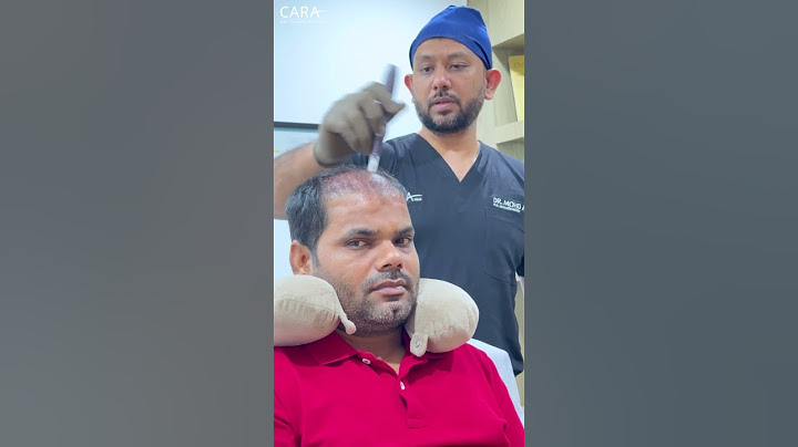 Cara PRP Hair Treatment for Hair Loss