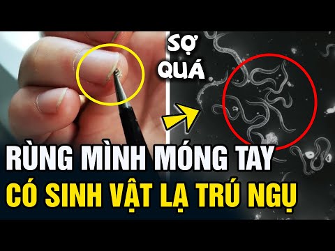 Video: Giun đất trắng (chui ra): mô tả, nuôi và bảo quản