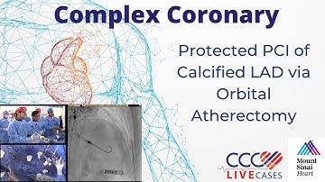 Protected PCI of Calcified LAD via Orbital Atherectomy - June 18, 2019