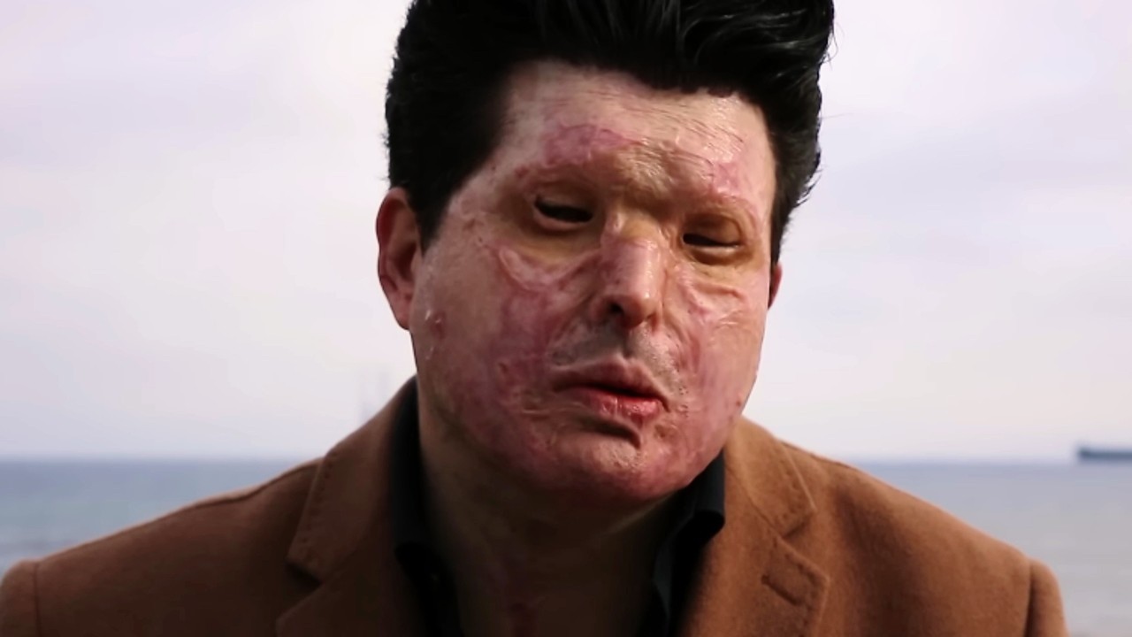 Лондонские банды: безумие кислотных атак