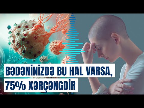 Xərçəngin genetik səbəbi ortaya çıxdı: Bu əlamətlər varsa, həkimə müraciət edin