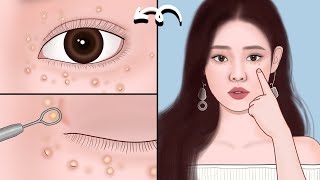 The safe way to remove milia around eyes | ASMR eye milia removal animation | Meng's Stop Motion