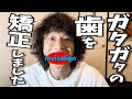 【歯列矯正】マウスピース矯正やってました！【before afterで見る歯並び】