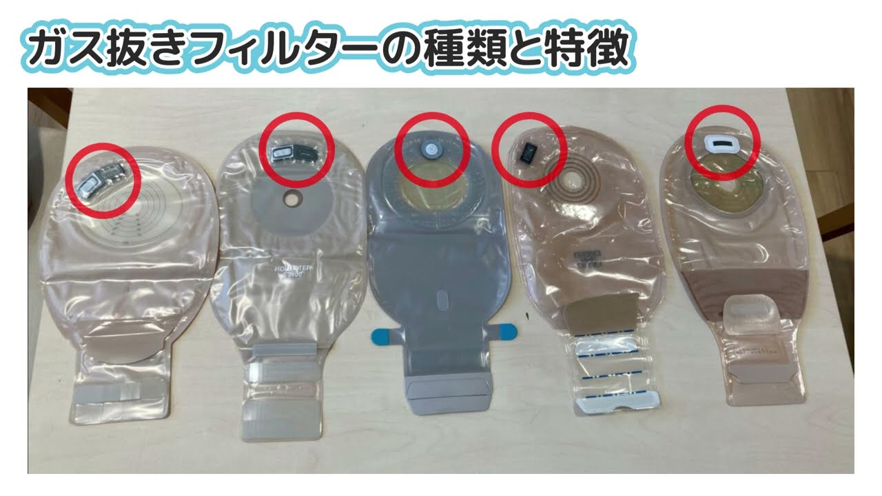 動画】ストーマ装具のガス抜きフィルターについて – ストーマケア.net
