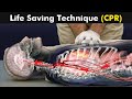 How cardiopulmonary resuscitation cpr is performed urduhindi