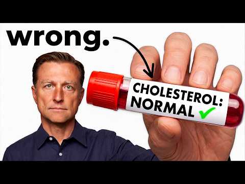 What is Normal Cholesterol (What Your Doctor Doesn’t Tell You)