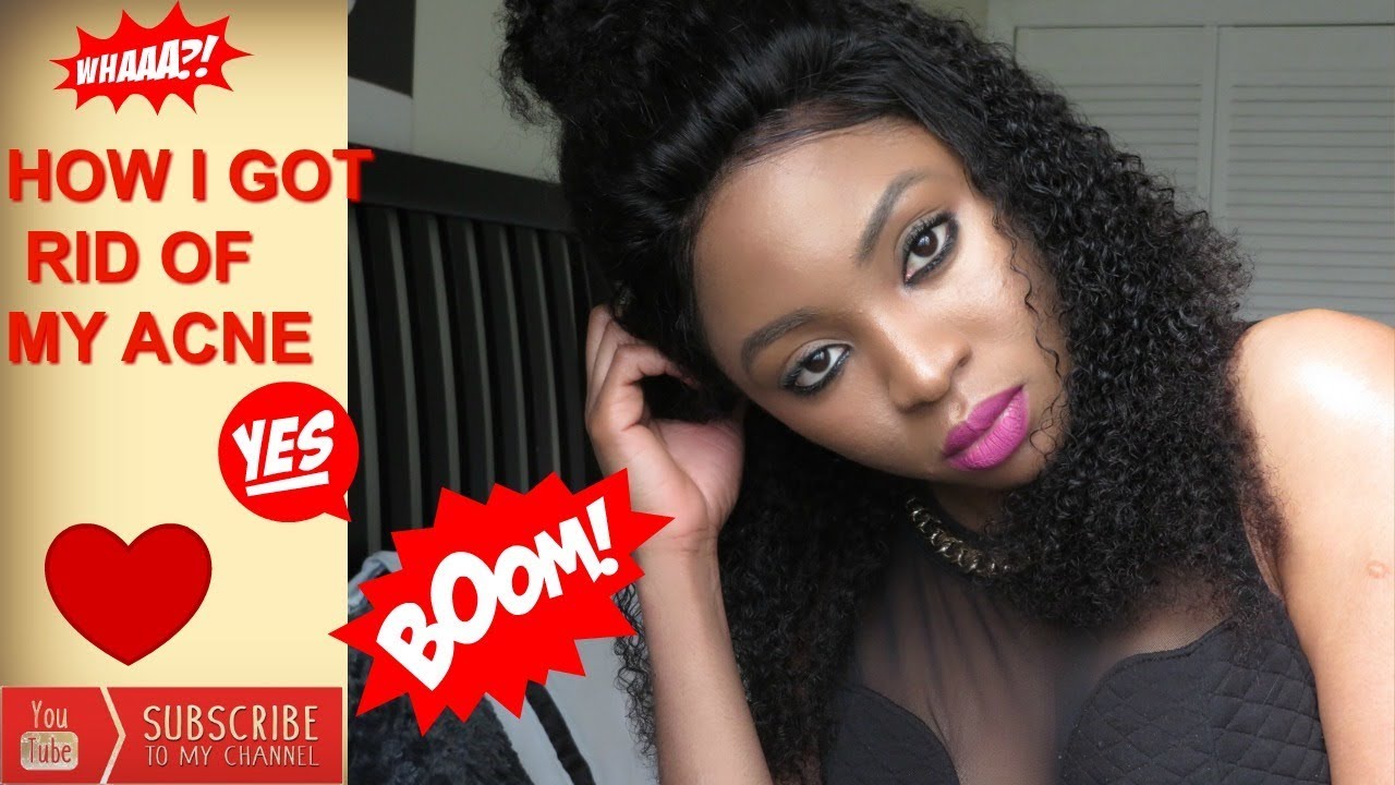 How I Got Rid Of My Acne/ Skin Care Routine (How To) - YouTube