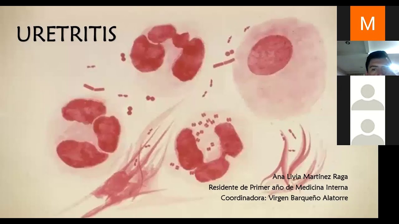 Uretritis - YouTube