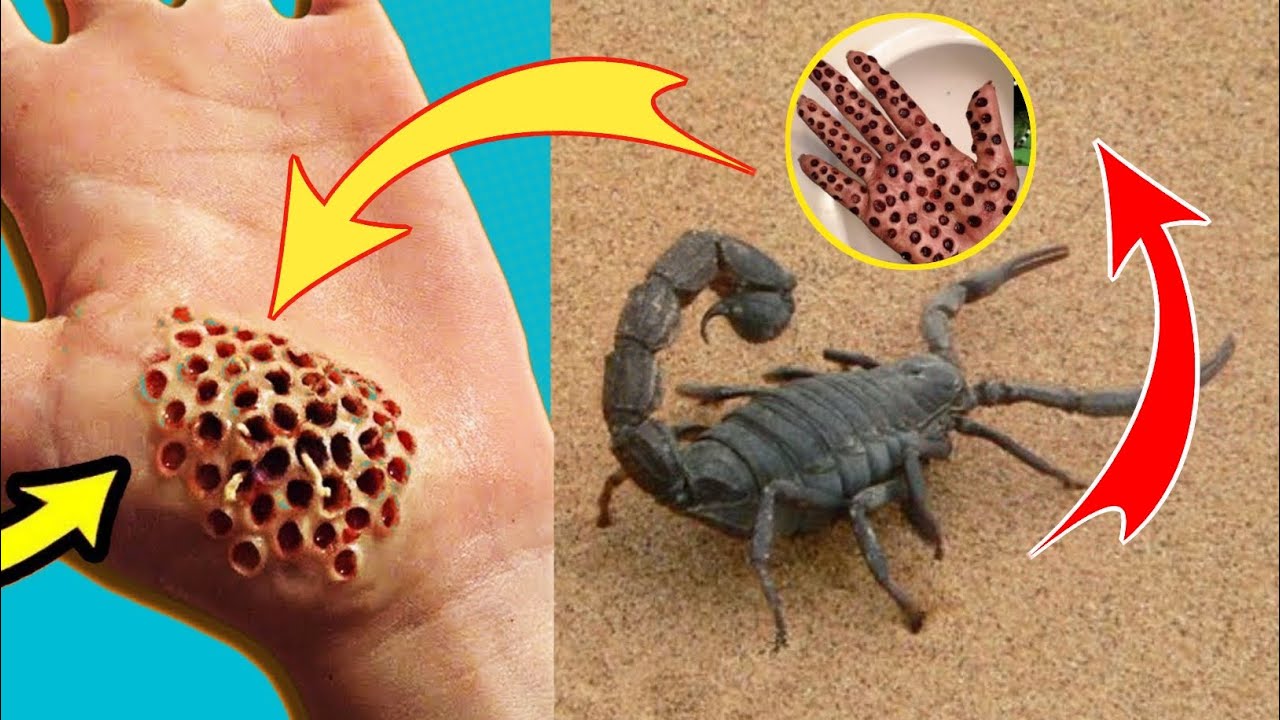 Facts About Scorpion In Hindi/Urdu | Information About Scorpions | Black Scorpion