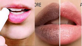 How to get rid of dark lips and get soft, smooth and fuller lips. Causes of dark lips. Lip care.