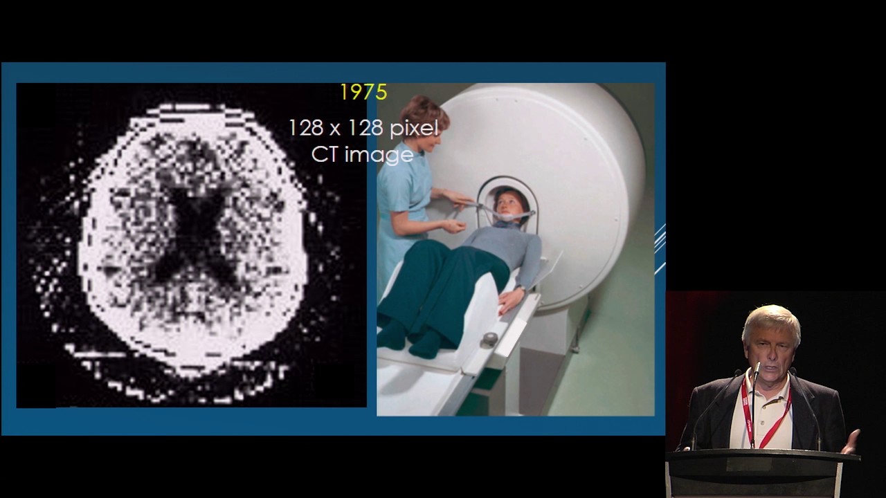 Advancements in CT Technology Improving Benefit vs. Risk