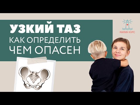 Узкий таз. Эфир с акушером-гинекологом Романом Гагаркиным