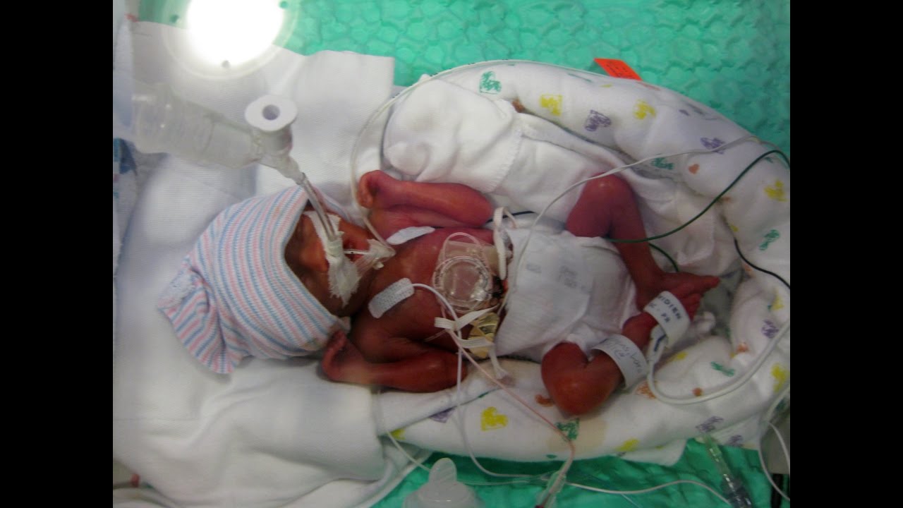 Evan S Nicu Journey Our Micro Preemie Born At 24 Weeks Youtube Evan S Nicu Journey Our Micro Preemie Born At 24 Weeks Youtube