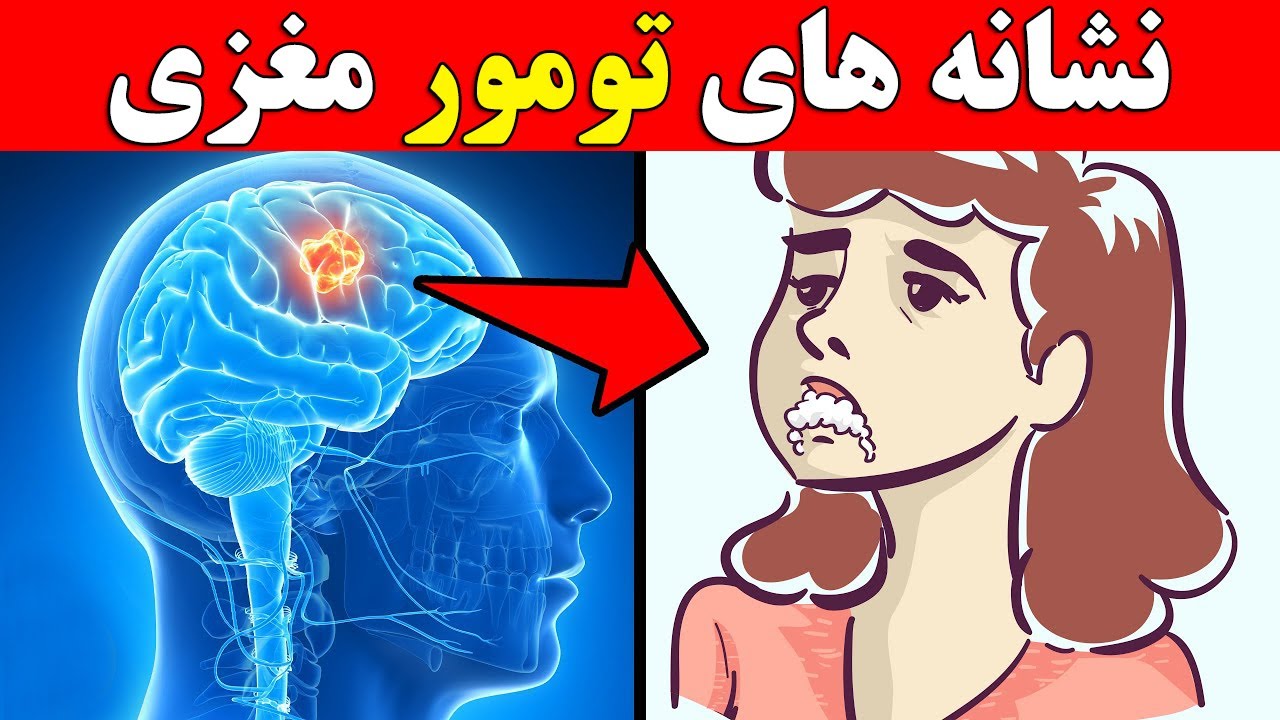 هفت علامت هشدار دهنده تومور مغزی که باید از آنها آگاه باشید !!