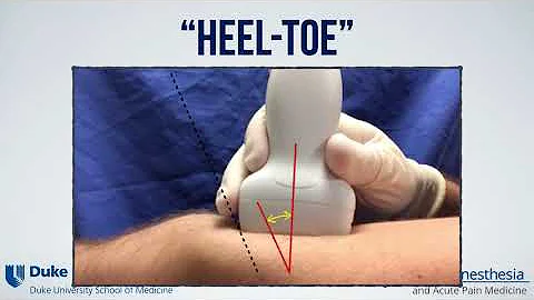 Ultrasound probe maneuvers to improve needle and target visualization