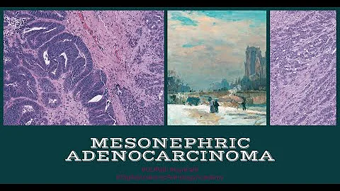 Mesonephric Adenocarcinoma