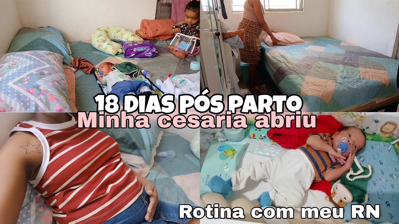 ROTINA 18 DIAS PÓS PARTO/FIZ LAQUEADURA  CUIDADOS COM MEU RN/AMAMENTAR DÓI.🩵 