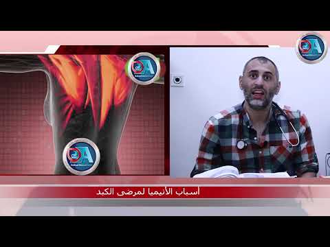 علاقة الكبد بأمراض الدم بالانيميا