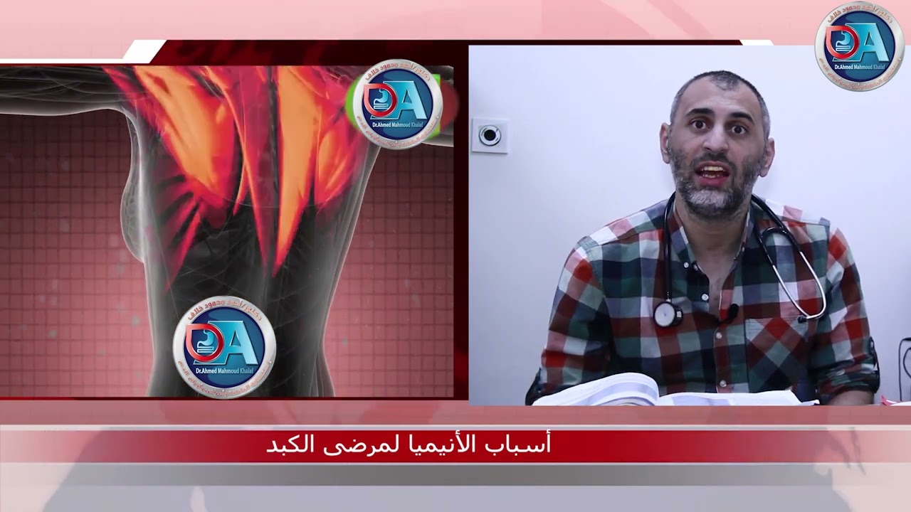 علاقة الكبد بأمراض الدم بالانيميا