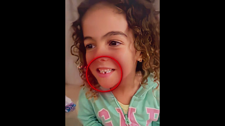 Ronaldo's Tooth Prank to Alana 😂