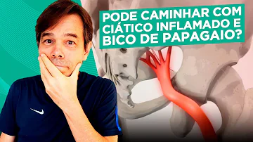 Pode fazer exercícios com nervo Ciatico inflamado?