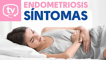 ¿Cuáles son los tres síntomas más comunes de la endometriosis?