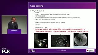 Your most challenging TAVI cases - Achieving precision & control with Evolut platform - EuroPCR 2022