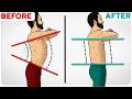 The Anterior Pelvic Tilt Fix For Perfect Posture
