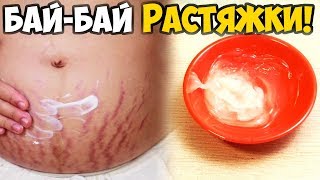 видео Как убрать растяжки на животе после родов в домашних условиях