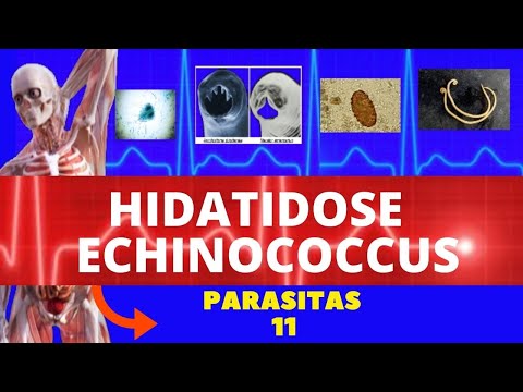 Vídeo: O Sistema único De Células-tronco Da Larva Imortal Do Parasita Humano Echinococcus Multilocularis