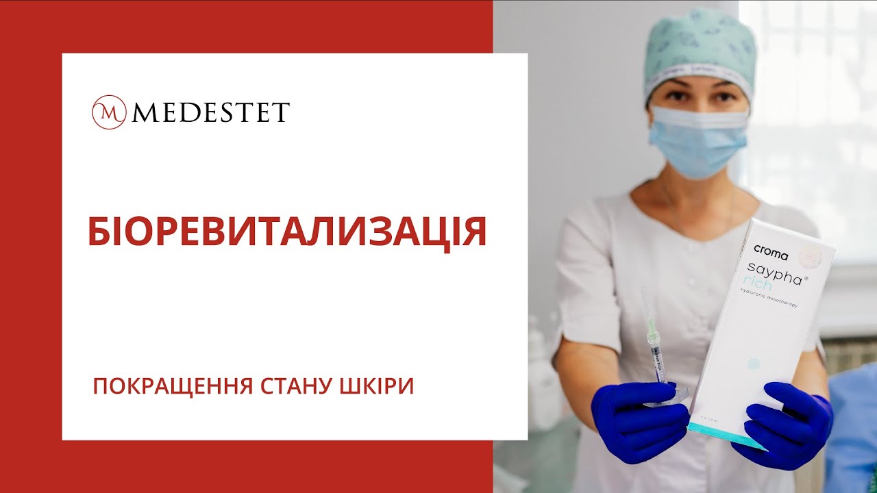 Биоревитализация препаратом Saypha Rich максимум гиалуроновой кислоты. Косметология Медэстет Винница