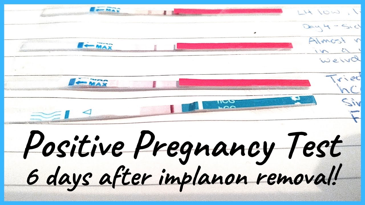 Positive Pregnancy Test 6 Days After Implanon Removal! YouTube
