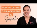 How to get rid of Blackheads