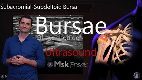 ULTRASOUND OF THE BURSAE OF THE SHOULDER (PART II) | Practical MSK Scanning Guide
