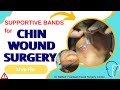 “Facial Wound Closure After Bicycle Injury | Step by Step Explained | Dr Mukund Rathod"