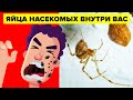 Насекомые откладывают яйца внутри вас (прямо сейчас).