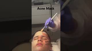 Acne Mask amor facial acnefacial acneproneskin blackheadremoval acnetreatment orlandoflorida