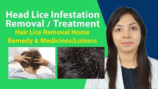 Head Lice Infestation: Causes, Symptoms and Medicine/Lotion | Home Remedies for Head Lice Removal