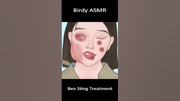 ASMR Treatment Bee Sting #asmr #satisfying #viralvideo #trending #shorts