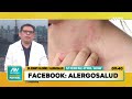 Dr. Ronny Palomino - ácaros del poco / rinitis / asma / dermatitis / Alergosalud