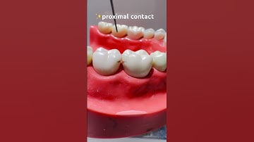 Proper proximal contact = balanced occlusion + healthy periodontium.”|Dr.Dentique-hub
