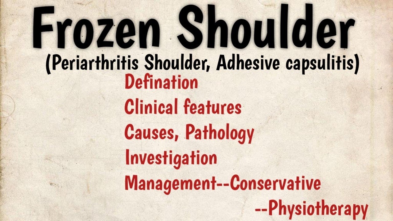 Frozen shoulder Notes, periarthritis, Adhesive capsulitis Clinical features Management YouTube