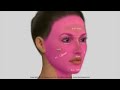 DermaPen