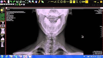 20/20 Imaging Opal-Rad (Chiropractic) Center Point Tool