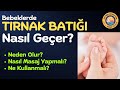 Bebeklerde Tırnak Batığı Nasıl Önlenir? Nasıl Masaj Yapmalı?