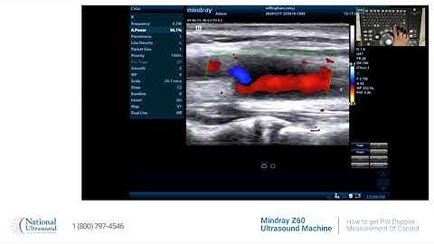 How to get PW doppler measurement of carotid on Mindray Z60