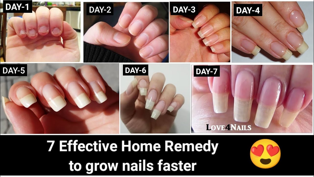 8 Ways to Make Your Nails Grow Faster, According to Dermatologists
