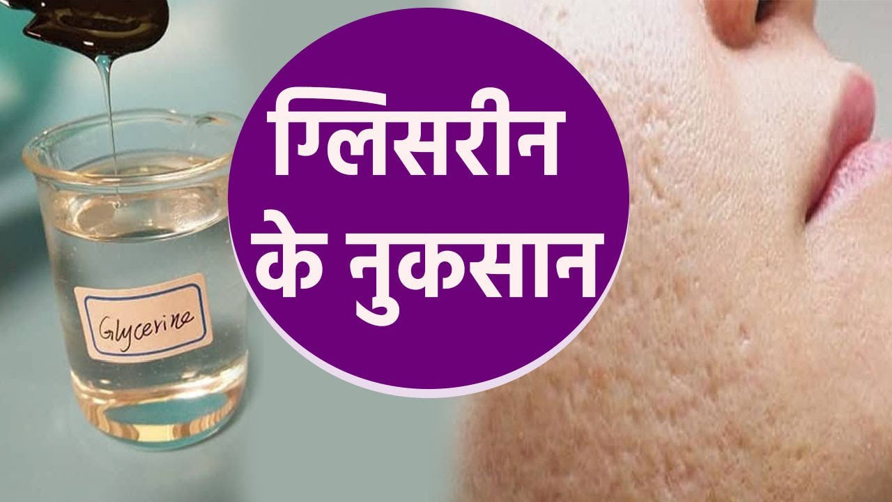 Winter में Glycerin का Use इन लोगो के लिए खतरनाक,भूलकर भी ये लोग न करे इस्तेमाल।ग्लिसरीन के नुकसान