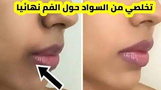 بمكونين فقط تخلصي من سواد حول الفم نهائيا واحصلي على بشره بيضاء موحده اللون #تخلص غمقان حول الفم