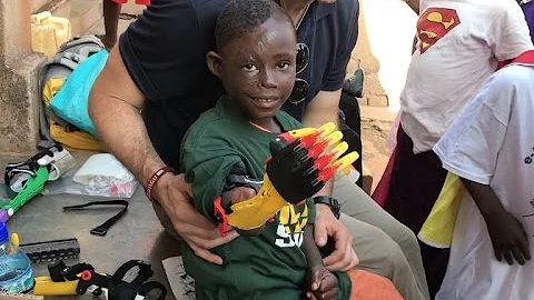 Saints 3D-Print Prosthetic Arm For Girl In Uganda